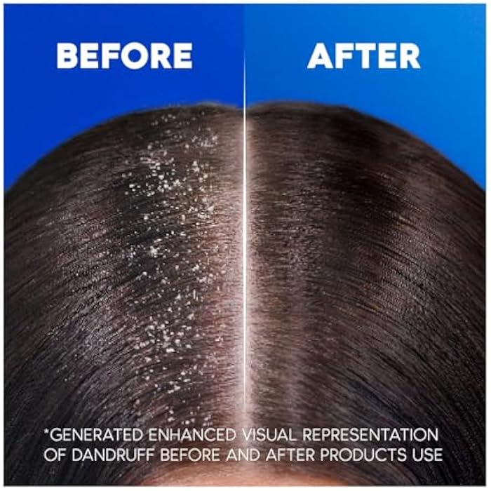 Head & Shoulders 3 x 200ml | Head & Shoulders Menthol Fresh Anti Dandruff Shampoo 200ml - Image 4